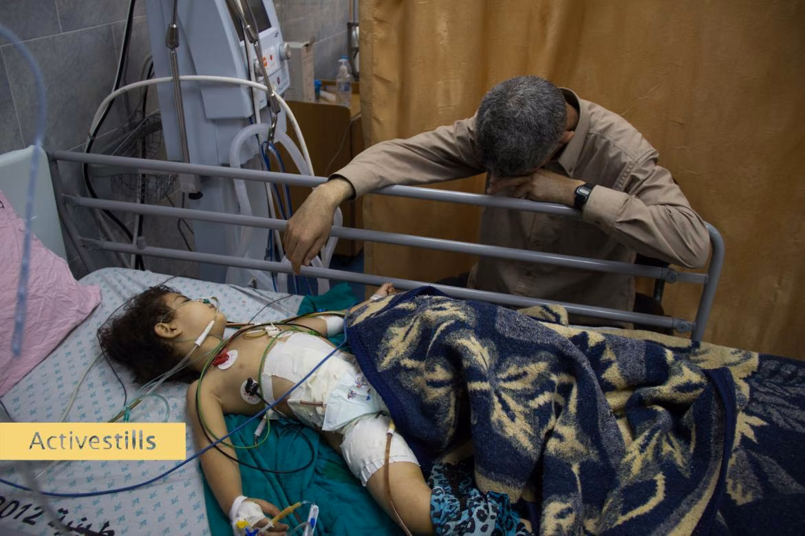 An injured Palestinian child lies in Kamal Edwan Hospital following the overnight Israeli shelling -Gaza hospitals